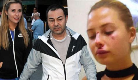 Serdar Ortaç’ın eşi Chloe Loughnan, Miami'de kaza geçirdi